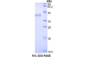 SDS-PAGE of Protein Standard from the Kit (Highly purified E.