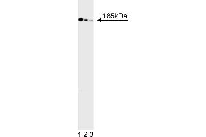 Western Blotting (WB) image for anti-Deleted in Colorectal Carcinoma (DCC) antibody (ABIN967443) (DCC anticorps)