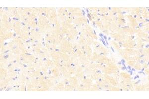 Detection of STAT3 in Mouse Cardiac Muscle Tissue using Polyclonal Antibody to Signal Transducer And Activator Of Transcription 3 (STAT3)