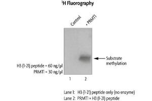 PRMT1 activity assay.
