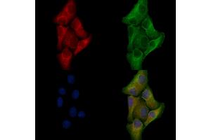 ABIN6257222 and ABIN6276028 staining Hela cells by IF/ICC. (GPR17 anticorps  (C-Term))