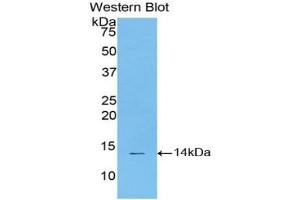 Detection of Recombinant STAT3, Bovine using Polyclonal Antibody to Signal Transducer And Activator Of Transcription 3 (STAT3)