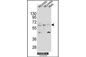 Western blot analysis in NCI-H292,NCI-H460 and A549 cell line lysates (35ug/lane). (LILRA2 anticorps  (AA 55-81))