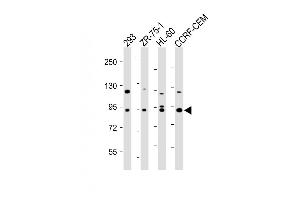 All lanes : Anti-P9 Antibody at 1:500-1:2000 dilution Lane 1: 293 whole cell lysate Lane 2: ZR-75-1 whole cell lysate Lane 3: HL-60 whole cell lysate Lane 4: CCRF-CEM whole cell lysate Lysates/proteins at 20 μg per lane. (MMP 9 anticorps)