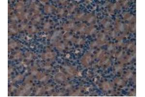 IHC-P analysis of Mouse Kidney Tissue, with DAB staining. (LIFR anticorps  (AA 381-485))