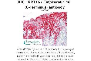 Image no. 1 for anti-Keratin 16 (KRT16) antibody (ABIN1736281) (KRT16 anticorps)