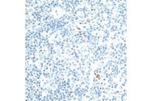 Immunohistochemistry (IHC) image for anti-V-Maf Musculoaponeurotic Fibrosarcoma Oncogene Homolog (Avian) (MAF) (AA 125-175) antibody (ABIN7455089) (Recombinant MAF anticorps  (AA 125-175))