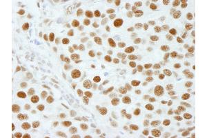 Immunohistochemistry (IHC) image for anti-5'-3' Exoribonuclease 2 (XRN2) (AA 900-950) antibody (ABIN7449038) (XRN2 anticorps  (AA 900-950))