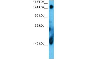 Host:  Rabbit  Target Name:  COIA1  Sample Type:  MCF7 Whole Cell  Antibody Dilution:  1.