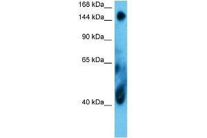 Host:  Rabbit  Target Name:  COIA1  Sample Type:  MCF7 Whole Cell  Antibody Dilution:  1. (COL18A1 anticorps  (Middle Region))