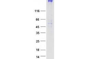 Validation with Western Blot