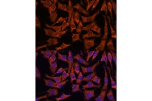 anti-Sec23 Homolog B (SEC23B) (AA 150-250) antibody