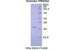 SDS-PAGE analysis of Human Peroxiredoxin 2 Protein. (Peroxiredoxin 2 Protein (PRDX2))