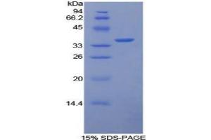 SDS-PAGE analysis of Rabbit Tissue Factor Protein. (Tissue factor Protéine)