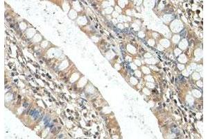 Immunohistochemical staining of formalin-fixed paraffin-embedded human fetal small intestine tissue showing cytoplasmic staining with RICTOR polyclonal antibody  at 1 : 100 dilution.
