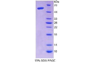SDS-PAGE (SDS) image for Aminoadipate Semialdehyde Synthase (AASS) (AA 33-455) protein (His tag) (ABIN4989583) (AASS Protein (AA 33-455) (His tag))