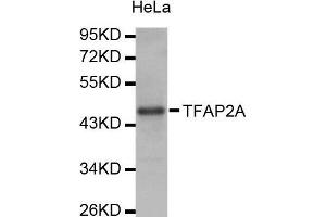 Western Blotting (WB) image for anti-Transcription Factor AP-2 alpha (Activating Enhancer Binding Protein 2 Alpha) (TFAP2A) (AA 1-437) antibody (ABIN1678679) (TFAP2A anticorps  (AA 1-437))
