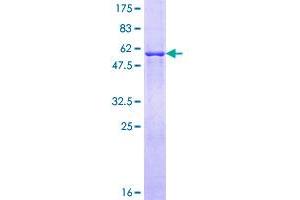 Image no. 1 for 3-Ketodihydrosphingosine Reductase (KDSR) (AA 12-332) protein (GST tag) (ABIN1308526)