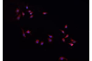 ABIN6268949 staining A-431 cells by IF/ICC. (CXCL1 anticorps  (Internal Region))