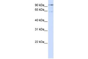 Western Blotting (WB) image for anti-Discs, Large (Drosophila) Homolog-Associated Protein 5 (DLGAP5) antibody (ABIN2458993) (DLGAP5 anticorps)