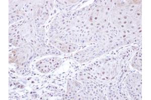 IHC-P Image Immunohistochemical analysis of paraffin-embedded Cal27 xenograft , using PSMC3, antibody at 1:500 dilution.