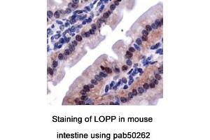 Image no. 2 for anti-Lysyl Oxidase Pro-Peptide (LOPP) (AA 78-115), (Internal Region) antibody (ABIN363571) (LOPP anticorps  (Internal Region))