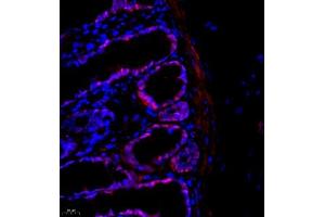Immunofluorescence of paraffin embedded rat colon using Thymosin (ABIN7075306) at dilution of 1:1000 (400x lens)