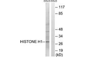 Western blot analysis of extracts from COLO cells, using Histone H1 (Ab-17) Antibody.