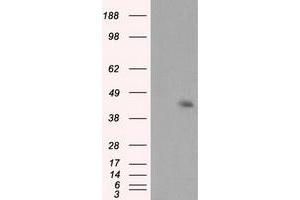 Image no. 3 for anti-Induced Myeloid Leukemia Cell Differentiation Protein Mcl-1 (MCL1) antibody (ABIN1499338)