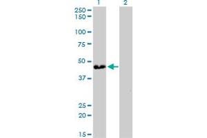 Western Blot analysis of ATP6V0D1 expression in transfected 293T cell line by ATP6V0D1 monoclonal antibody (M01), clone 2G12. (ATP6V0D1 anticorps  (AA 238-308))