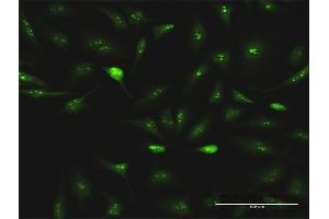 Immunofluorescence of purified MaxPab antibody to ESF1 on HeLa cell. (ESF1 anticorps  (AA 1-851))