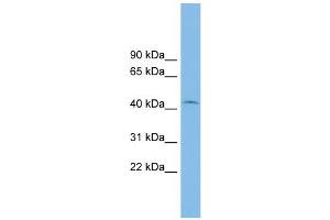 WB Suggested Anti-RIBC1 Antibody Titration: 0. (RIBC1 anticorps  (Middle Region))