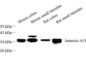 Western blot analysis of Annexin-A13 (ABIN7073062) at dilution of 1: 500 (Annexin A13 anticorps)