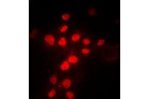 Immunofluorescent analysis of MLH1 staining in HeLa cells. (MLH1 anticorps  (Center))