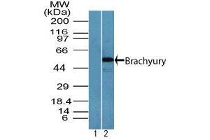 Image no. 2 for anti-T Brachyury Protein (AA 350-400) antibody (ABIN960367) (T Brachyury Protein (AA 350-400) anticorps)