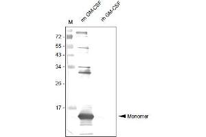 Western Analysis of anti-Mouse GM-CSF Antibody . (GM-CSF anticorps  (AA 18-141))