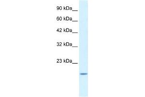 WB Suggested Anti-BAX Antibody Titration:  1. (BAX anticorps  (N-Term))