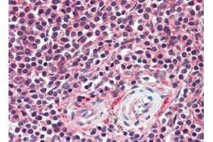 Human Spleen (formalin-fixed, paraffin-embedded) stained with APAF1at 10 µg/ml followed by biotinylated goat anti-rabbit IgG secondary antibody, alkaline phosphatase-streptavidin and chromogen. (APAF1 anticorps  (C-Term))