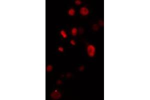 ABIN6274504 staining Hela cells by IF/ICC. (ZNF541 anticorps  (Internal Region))