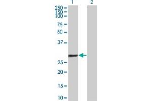 Western Blot analysis of GSTO1 expression in transfected 293T cell line by GSTO1 polyclonal antibody (A01). (GSTO1 anticorps  (AA 121-209))