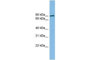WB Suggested Anti-ERCC3 Antibody Titration: 0.