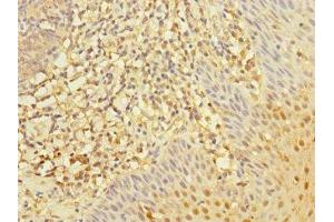 Immunohistochemistry of paraffin-embedded human tonsil tissue using ABIN7167590 at dilution of 1:100 (RGS1 anticorps  (AA 1-181))