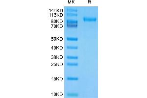 Human CDH17 Domain 1-6 on Tris-Bis PAGE under reduced condition.