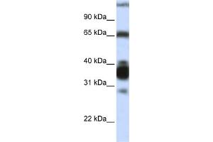 WB Suggested Anti-ARG1 Antibody Titration:  0. (Liver Arginase anticorps  (N-Term))