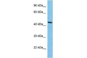 Host:  Rabbit  Target Name:  ACHB3  Sample Type:  A549 Whole Cell lysates  Antibody Dilution:  1. (ACHB3 anticorps  (N-Term))