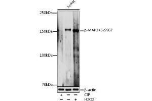 Western blot analysis of extracts of Jurkat cells, using Phospho-MK5-S967 antibody (ABIN7268655) at 1:1000 dilution. (ASK1 anticorps  (pSer967))