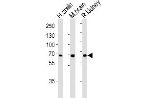 Western blot analysis of lysates from human brain, mouse brain ad rat kidney tissue lysate (from left to right), using GLS Antibody (C-term) (ABIN652757 and ABIN2842498).