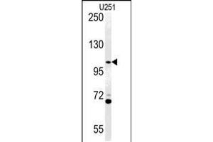 Western blot analysis of ACAP3 Antibody in U251 cell line lysates (35ug/lane) (Acap3 anticorps  (N-Term))
