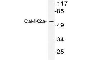 Western blot (WB) analyzes of CaMK2-a antibody in extracts from A431 cells.