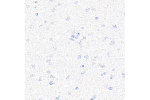 Immunohistochemistry of paraffin-embedded Human brain (negative control sample) using CD7 antibody (ABIN7266214) at dilution of 1:10000 (40x lens). (CD7 anticorps)
